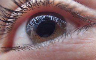 ¿Qué es el glaucoma?